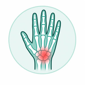 Arthritis